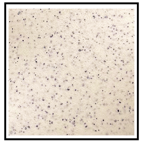 QUARTZ FOAM